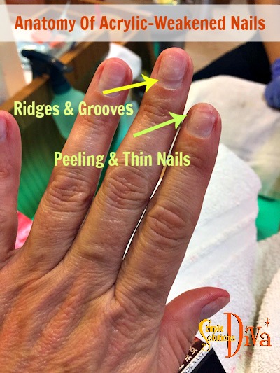 anatomy of nails